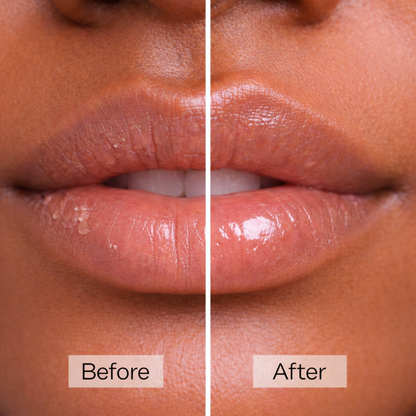 Hydrating Lip Mask™